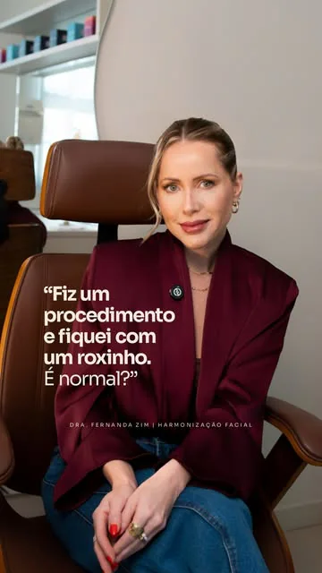 Capa do reel de 13 de outubro: a Dra. Fernanda Zim sentada em poltrona de couro, de blazer vinho. A imagem traz a pergunta “Fiz um procedimento e fiquei com um roxinho. É normal?”.